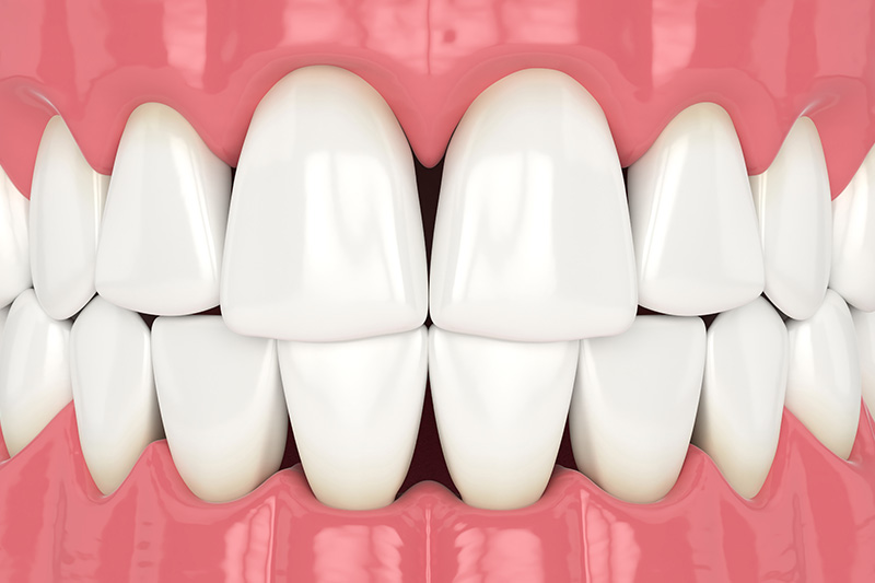 Crossroads Dental Group Special Offer